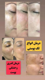 صابون روشن کننده پوست وکرم مکمل